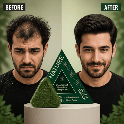 🌿 Nature Herbal Triangle Soap Bar – Free Shipping 🚚